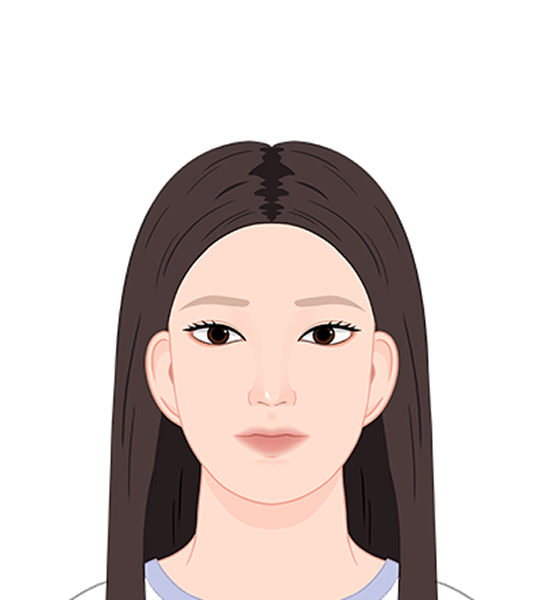 타원형