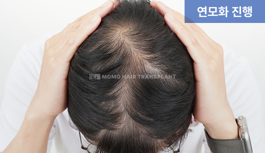 연모화 진행