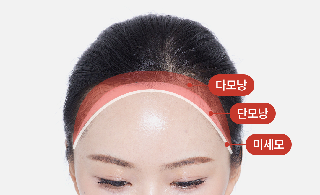 이마 그라데이션 이식