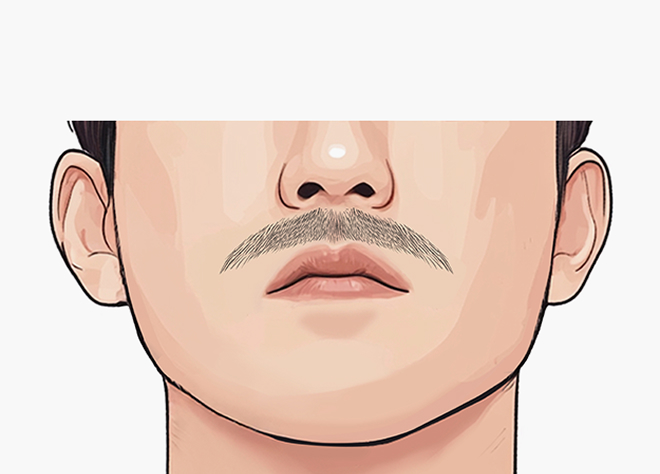 브이형드 구레나룻